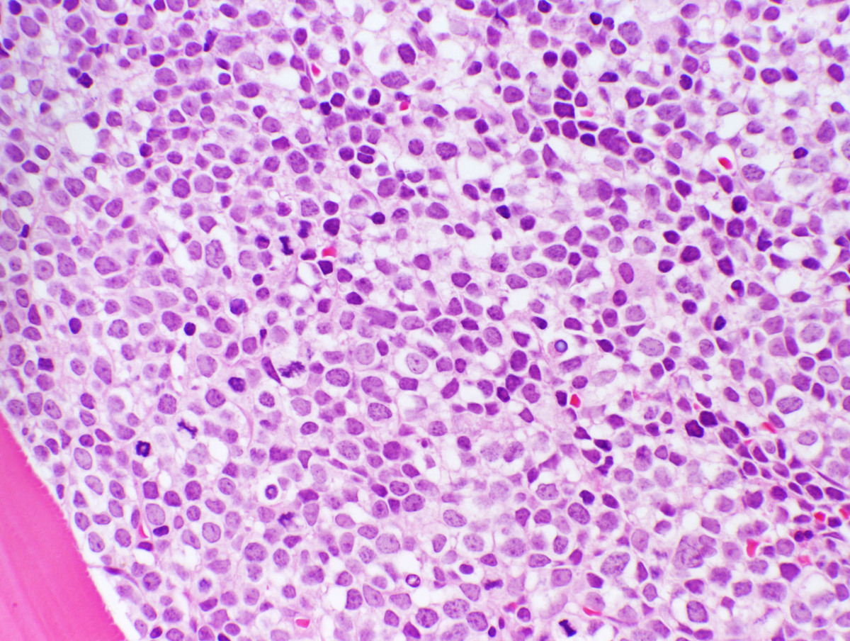 Bone Marrow Core HP 400x